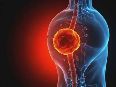 紫微斗數論疾病星辰的類象